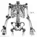 Fig. 10 - Wearing-type movement assistance device