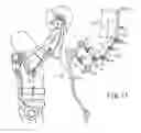 Fig. 12 - Wearing-type movement assistance device