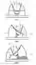 Fig. 03 - THREE-DIMENSIONAL PRINTER WITH INDEPENDENTLY MOVABLE PRINTER ROBOT