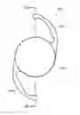 Fig. 01 - Process for manufacturing an intraocular lens with an embedded mask