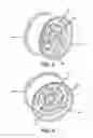 Fig. 04 - Attachment structure for visible wheel features