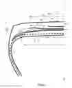 Fig. 03 - Tire comprising a layer of circumferential reinforcing elements