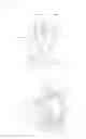 Fig. 12 - Headrest moving device