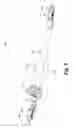 Fig. 10 - Switchable retractor