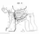 Fig. 04 - Deformation suppressing structure of vehicle