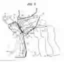 Fig. 07 - Deformation suppressing structure of vehicle