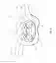 Fig. 12 - STEERING WHEEL VIBRATION SUPPRESSORS