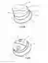 Fig. 16 - Container having a head piece, which container can be or is filled with a medium