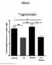 Fig. 07 - METHODS OF LOWERING PROPROTEIN CONVERTASE SUBTILISIN/KEXIN TYPE 9 (PCSK9)