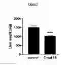 Fig. 08 - METHODS OF LOWERING PROPROTEIN CONVERTASE SUBTILISIN/KEXIN TYPE 9 (PCSK9)