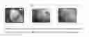 Fig. 08 - 3-phenyl-7-hydroxy-isocoumarins as macrophage migration inhibitory factor (MIF) inhibitors