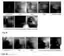 Fig. 05 - Synthesis and composition of photodynamic therapeutic agents for the targeted treatment of cancer