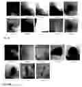 Fig. 19 - Synthesis and composition of photodynamic therapeutic agents for the targeted treatment of cancer