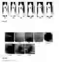 Fig. 37 - Synthesis and composition of photodynamic therapeutic agents for the targeted treatment of cancer