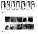 Fig. 47 - Synthesis and composition of photodynamic therapeutic agents for the targeted treatment of cancer