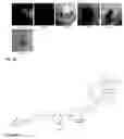 Fig. 48 - Synthesis and composition of photodynamic therapeutic agents for the targeted treatment of cancer