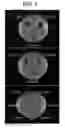 Fig. 04 - Antimicrobial peptides, pharmaceutical compositions, and methods of use thereof