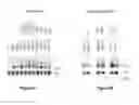 Fig. 06 - Fetal hemoglobin for genetic correction of sickle cell disease