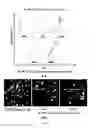 Fig. 04 - Chimeric antigen receptor hCD87-CAR and applications thereof