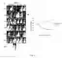 Fig. 06 - Chimeric antigen receptor hCD87-CAR and applications thereof