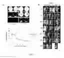 Fig. 07 - Chimeric antigen receptor hCD87-CAR and applications thereof
