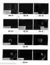 Fig. 07 - Anti-MCAM antibodies and associated methods of use