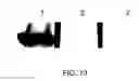 Fig. 11 - Antibody Substituting for Function of Blood Coagulation Factor VIII