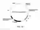 Fig. 20 - Antibody Substituting for Function of Blood Coagulation Factor VIII