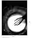 Fig. 10 - LEAK REPAIR COMPOSITIONS AND METHODS