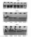 Fig. 02 - Compositions and methods for controlling paraffin and asphaltene problems in wells