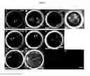 Fig. 07 - Microfluidic dual-well device for highthroughput single-cell capture and culture