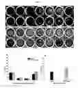 Fig. 08 - Microfluidic dual-well device for highthroughput single-cell capture and culture