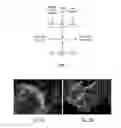 Fig. 02 - Method for stem cell differentiation in vivo by delivery of morphogenes with mesoporous silica and corresponding pharmaceutical active ingredients