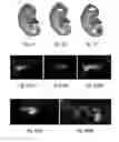 Fig. 06 - Method for stem cell differentiation in vivo by delivery of morphogenes with mesoporous silica and corresponding pharmaceutical active ingredients