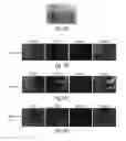 Fig. 07 - Method for stem cell differentiation in vivo by delivery of morphogenes with mesoporous silica and corresponding pharmaceutical active ingredients