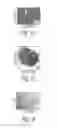 Fig. 04 - Mesenchymal stem cells derived from induced pluripotent stem cells