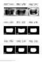 Fig. 16 - SELF-ASSEMBLING CELL AGGREGATES AND METHODS OF MAKING ENGINEERED TISSUE USING THE SAME