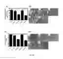 Fig. 80 - METHODS AND COMPOSITIONS FOR THE TREATMENT OF CANCER