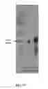 Fig. 18 - PROTEIN PRODUCTION IN MICROORGANISMS OF THE PHYLUM LABYRINTHULOMYCOTA