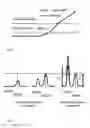 Fig. 02 - Quantification methods to determine initial template concentration by means of asymmetric amplification