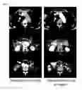 Fig. 03 - Methods of detecting cancers sensitive to cabozantinib