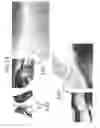Fig. 16 - High Strength Iron-Based Alloys, Processes for Making Same, and Articles Resulting Therefrom