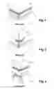 Fig. 02 - Device for layering floor and wall coverings for outside corners