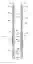 Fig. 01 - Downhole tool impact dissipating tool