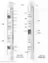 Fig. 02 - Downhole Tool having Slips Set by Stacked Rings