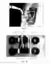 Fig. 16 - Rotary actuator utilizing pneumatically actuated elastomeric structures