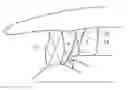Fig. 01 - Gas turbine engine