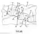 Fig. 04 - Coupling system comprising self locking joint