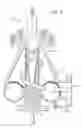 Fig. 06 - Combustion Engine Exhaust Treatment Systems and Methods