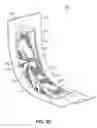 Fig. 05 - Passive internal ice protection systems for engine inlets
